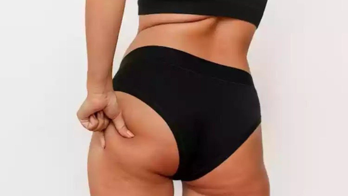 Emagreceu e engordou? O bumbum pode mudar mesmo assim